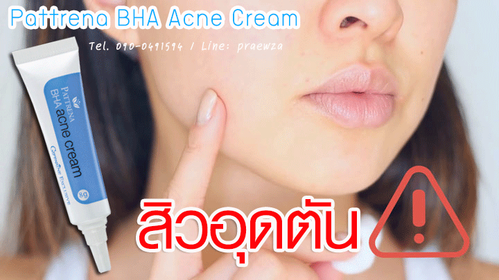 ครีมแต้มสิวอุดตัน กิฟฟารีน แพททรีน่า บีเอชเอ แอคเน่ ครีม
