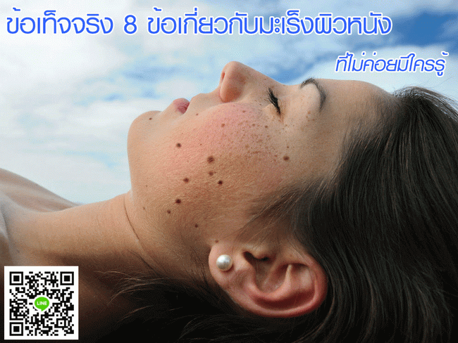 มะเร็งผิวหนัง