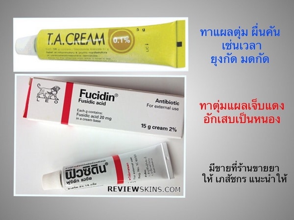 ยาทาแก้คัน, Fucidin, ฟิวซิดิน, T.A. Cream