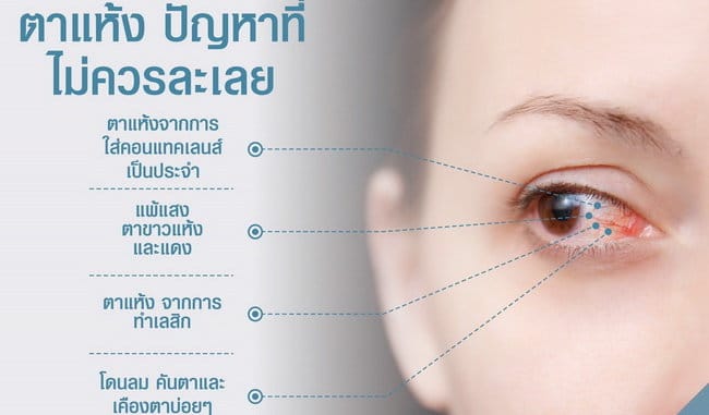 อควา เทียร์ กิฟฟารีน Aqua Tear_01 อควาเทียร์ กิฟฟารีน, Aqua Tear